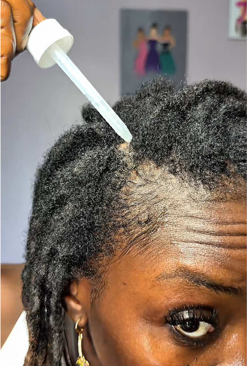 Kirkland Minoxidil 5% for Men & Women Universal Solution for Pattern Baldness… creator video