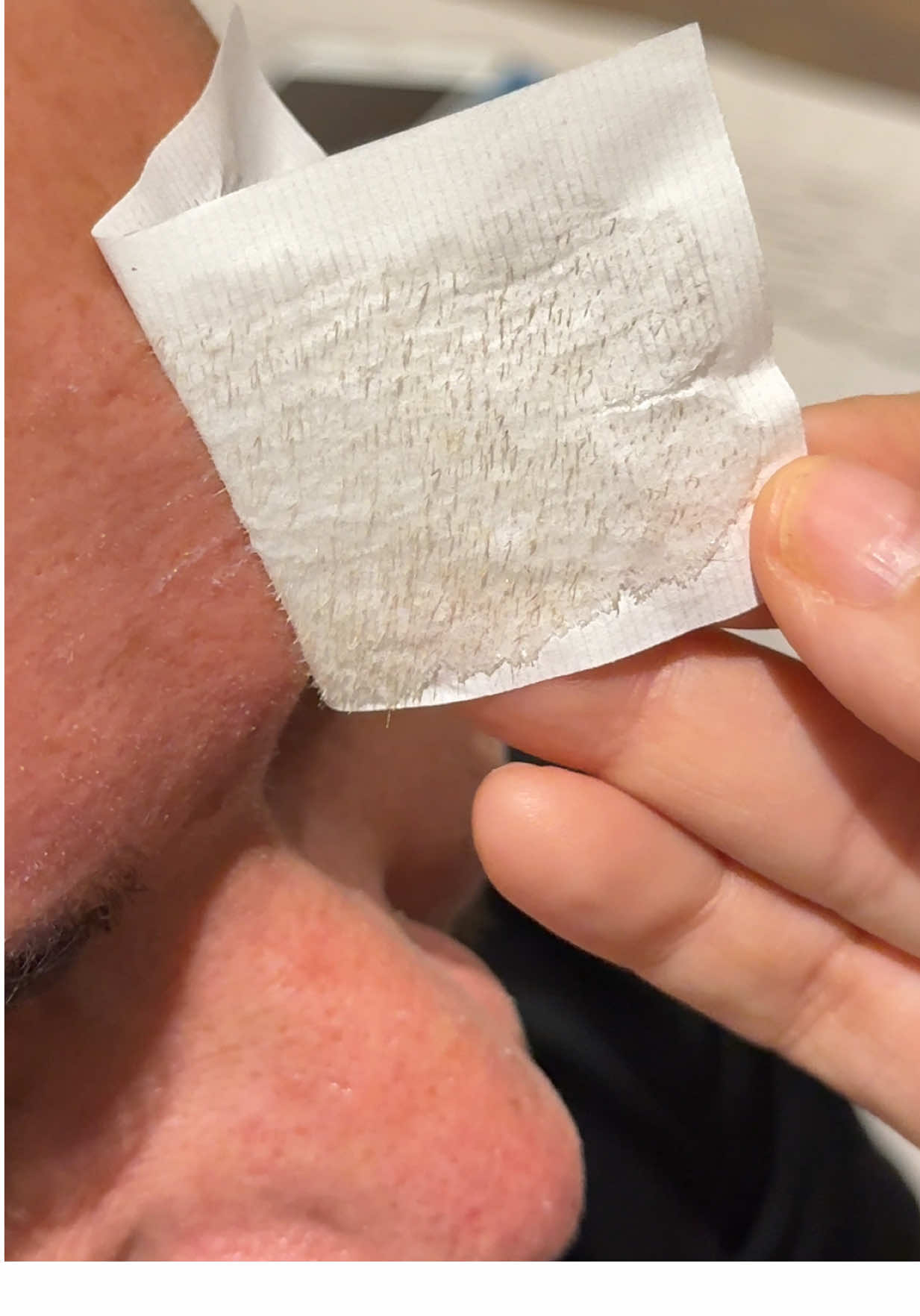 LANBENA Blackhead Removal Mask, Nose Phyto Pore Strips, Pore Cleansing Purifying Exfoliating… creator video